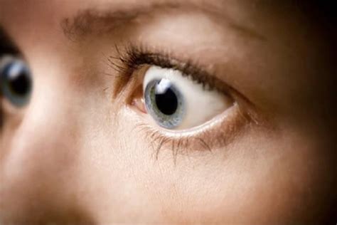 Bulging Eyes (Exophthalmos or Proptosis): Causes & Treatment | MyVision.org