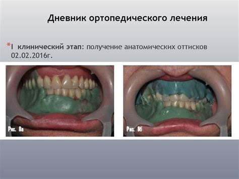 Ортопедическая стоматология. История болезни - презентация онлайн