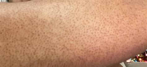 Help me clear this up : r/Skincare_Addiction