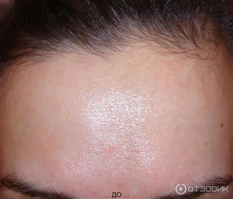 Отзыв о Тоник балансирующий для сужения пор Pore-Balance Aravia для ...