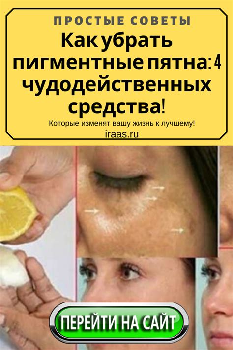 Как убрать пигментные пятна: 4 чудодейственных средства! | Health, Hair ...