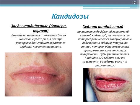 Микология - презентация онлайн