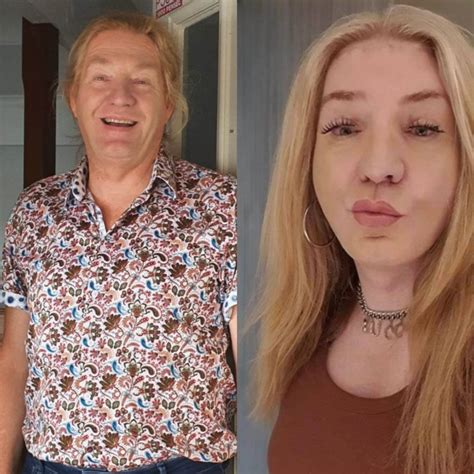 MTF PROCEDURES - Thailand Makeover
