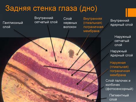 Гистология. Диагностика №2. Нерв (сосудисто-нервный пучок ...