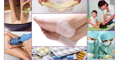 Болезнь Хаглунда Шинца – признаки у детей с фото, методы лечения и ...