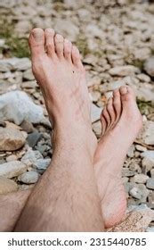 Scratch On Skin Traces Damage Human Stock Photo 2315440785 | Shutterstock
