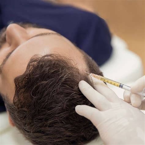 PRP Scalp Injection - Full - Innersource Medicine