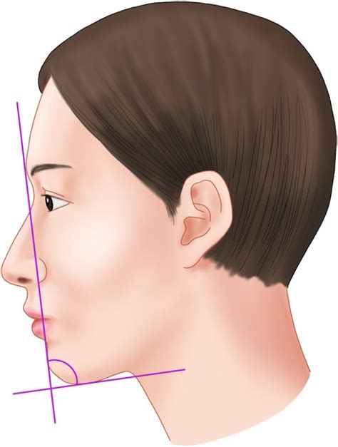 anatomical consideration  double chin thread lifting pmc
