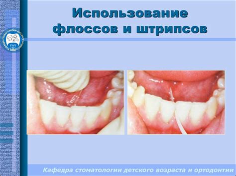 Профессиональная гигиена полости рта - презентация онлайн