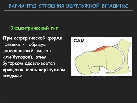 Визуализация тазобедренного сустава