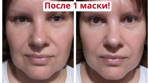 От морщин и пигментации! Мгновенный лифтинг и ровный тон своими руками ...