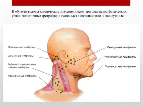 Лимфаденит. Лимфоузлы - online presentation