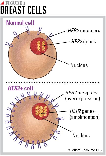 Breast Cancer HER2+ Overview and Staging