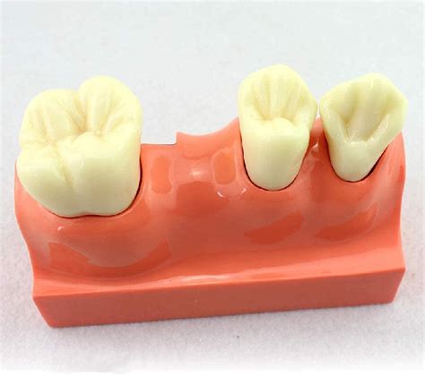 Buy NEFSO Teaching Model, Teeth Anatomical Model - Detachable