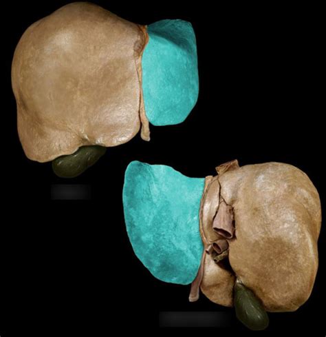 liver diagram quizlet