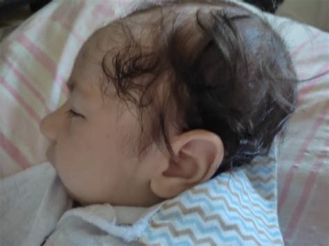 Cabeça do bebê | BabyCenter
