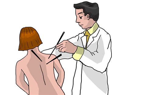Download Acupuncture, Acupuncturist, Alternative. Royalty-Free Stock ...