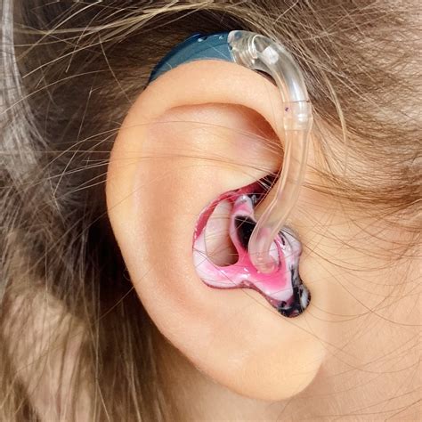 Hearing Aid Ear Molds