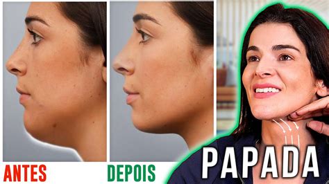 Como Tirar A Papada Do Pescoço - TIRE A PAPADA do Pescoço Naturalmente SEM LIPO - YouTube