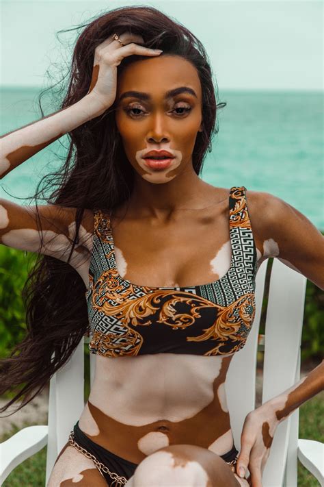 Winnie Harlow in Bikini - V Magazine Photos • CelebMafia