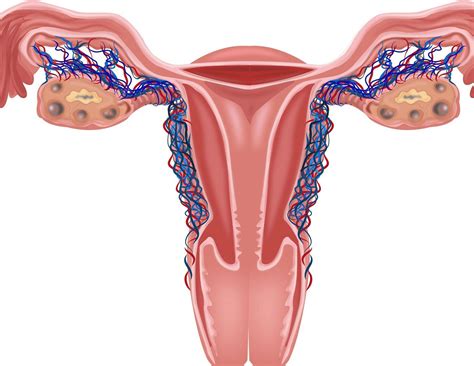 Симптомы Полипов Фото – Telegraph