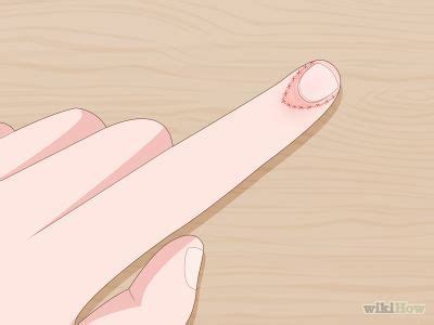 how to fix short nail beds