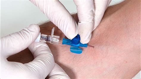 Insert The Cannula!! Cannula!! How to insert the cannula!! Parts of ...