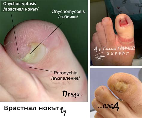 Д-р Галин ГАНЧЕВ - хирург