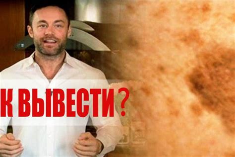 Как убрать пигментные пятна