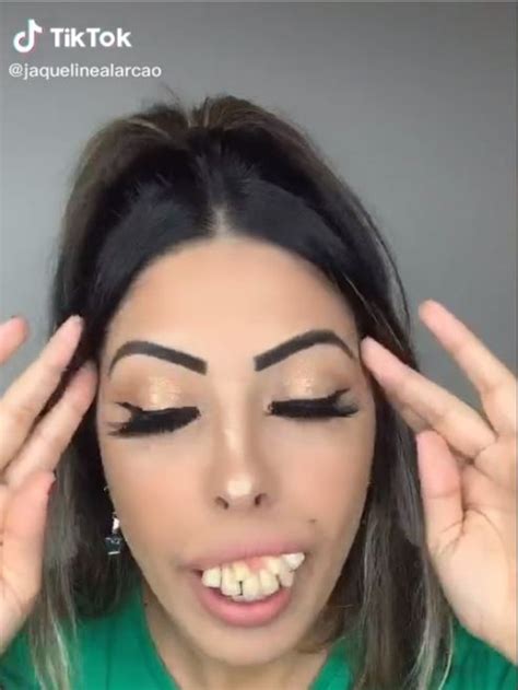 Truth about Jaqueline Alarcão’s viral teeth transformation in TikTok ...