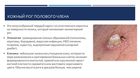 Заболевания мужской репродуктивной системы - презентация онлайн