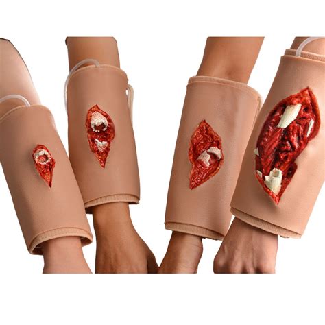 Wearable Open Fracture Wound Care Trainer - Type II, IIIA-IIIC – Ultrassist