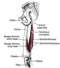 Экстензоры бедра (hamstrings)