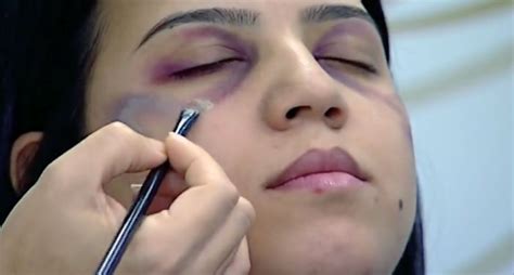 How To Cover Up A Bruise With Makeup | Makeupview.co