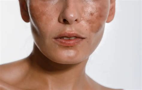 repair damaged skin  bleaching  comprehensive guide