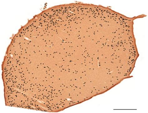 Neonatal sound-exposed + no sound stimulation | Download Scientific Diagram