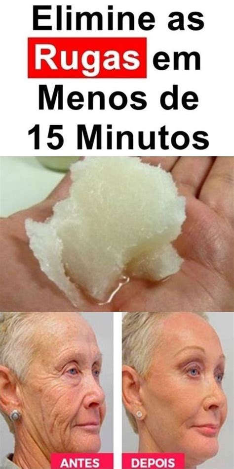 O Que É Bom Para Rugas - Como eliminar as rugas sem ir ao dermatologista (Passo a Passo) | Rugas ...