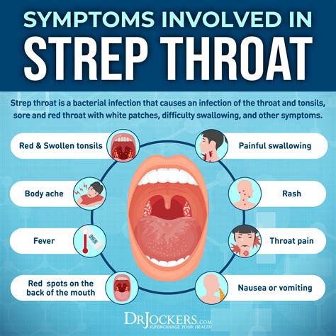 Strep Throat: Symptoms and 15 Natural Support Strategies | Strep throat