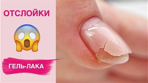 Причины отслойки гель-лака | Секреты носки маникюра - YouTube