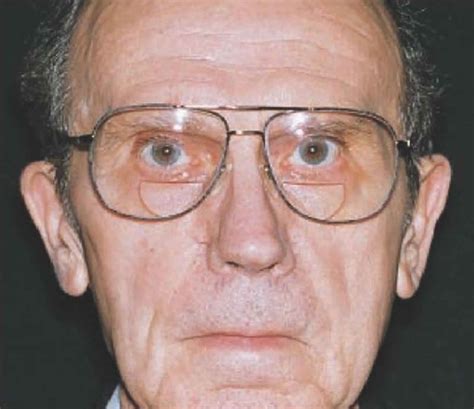 mask face  parkinsons disease  lachlan ricardo blog