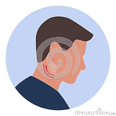 Man With Swollen Lymph Nodes Cartoon Vector | CartoonDealer.com #291952513