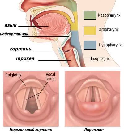 Таблетки за смучене при ларингит при възрастни и деца