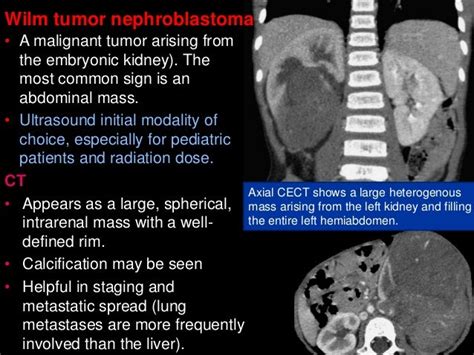 2 abdomen pathology ct