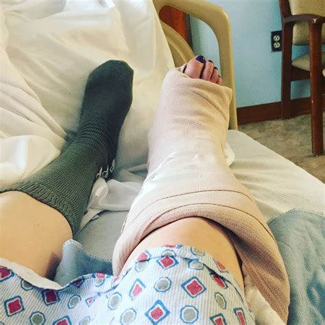 Dislocated Her Ankle