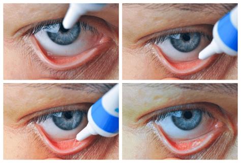 13 Conjunctival Sac Royalty-Free Images, Stock Photos & Pictures ...