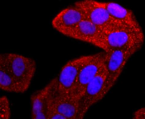 TIA-1 Antibody (MA5-32615)