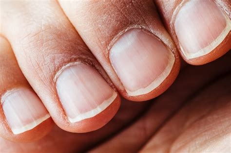 Premium Photo | Detail of the nail close up