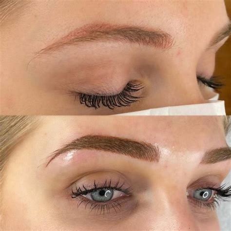 Fixing Bad Microblading - When to Correct and When to Remove