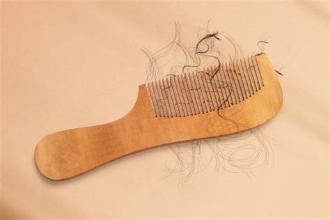 heres   hair   thinning dermatologists