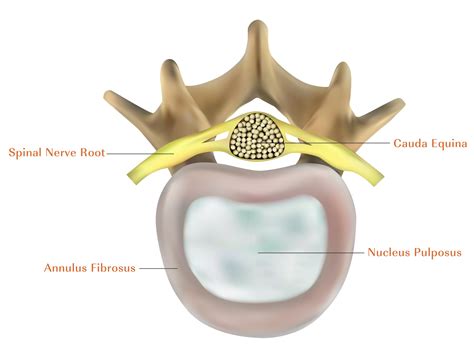 Lumbar Spine Patient Education — Camber Spine Med Tech